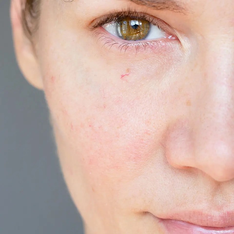 do wet wipes contain alcohol